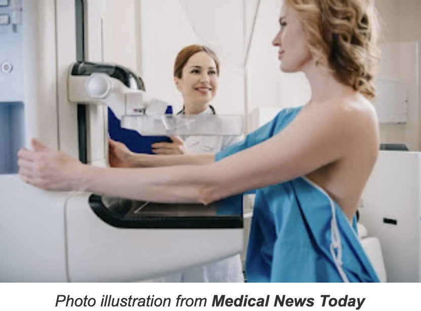New official recommendation: Women should start every-other-year mammograms at age 40; some groups favor annual scans